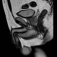 снимок МРТ яичек у мужчин